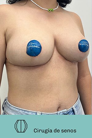 Clínica de cirugía plástica en Quito con el Dr. Leonardo Zambrano