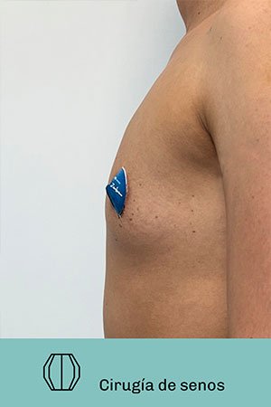 Clínica de cirugía plástica en Quito con el Dr. Leonardo Zambrano