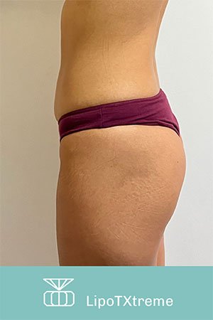 Clínica de cirugía plástica en Quito con el Dr. Leonardo Zambrano