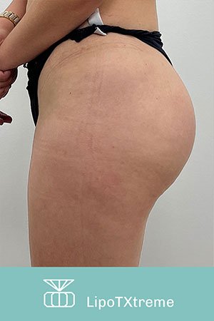 Clínica de cirugía plástica en Quito con el Dr. Leonardo Zambrano