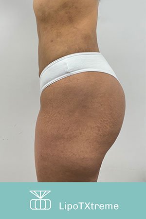 Clínica de cirugía plástica en Quito con el Dr. Leonardo Zambrano