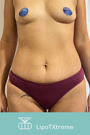 Clínica de cirugía plástica en Quito con el Dr. Leonardo Zambrano