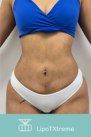 Clínica de cirugía plástica en Quito con el Dr. Leonardo Zambrano