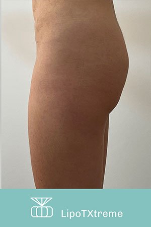 Clínica de cirugía plástica en Quito con el Dr. Leonardo Zambrano