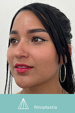 Clínica de cirugía plástica en Quito con el Dr. Leonardo Zambrano