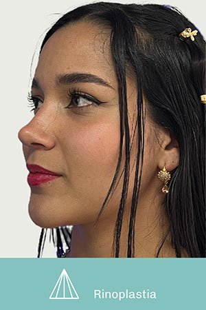 Clínica de cirugía plástica en Quito con el Dr. Leonardo Zambrano