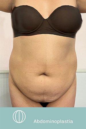 Clínica de cirugía plástica en Quito con el Dr. Leonardo Zambrano