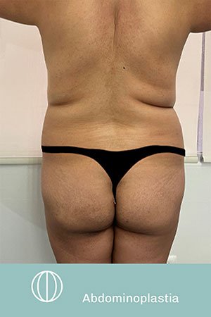 Clínica de cirugía plástica en Quito con el Dr. Leonardo Zambrano