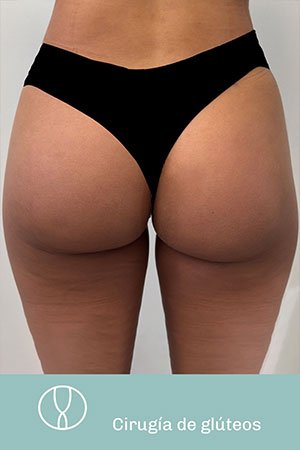 Clínica de cirugía plástica en Quito con el Dr. Leonardo Zambrano