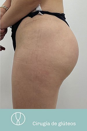 Clínica de cirugía plástica en Quito con el Dr. Leonardo Zambrano