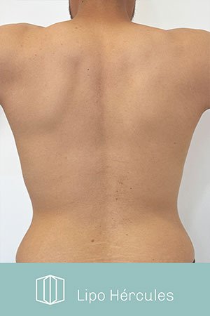 Clínica de cirugía plástica en Quito con el Dr. Leonardo Zambrano