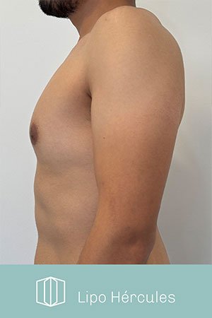 Clínica de cirugía plástica en Quito con el Dr. Leonardo Zambrano