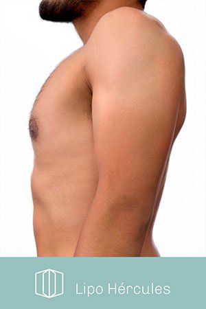 Clínica de cirugía plástica en Quito con el Dr. Leonardo Zambrano