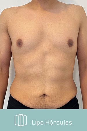 Clínica de cirugía plástica en Quito con el Dr. Leonardo Zambrano