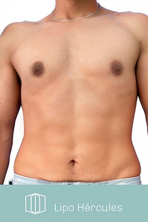 Clínica de cirugía plástica en Quito con el Dr. Leonardo Zambrano