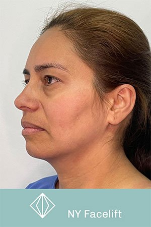 Clínica de cirugía plástica en Quito con el Dr. Leonardo Zambrano