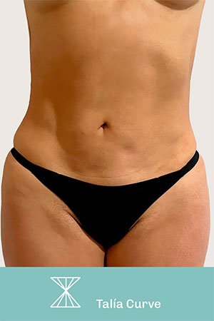 Clínica de cirugía plástica en Quito con el Dr. Leonardo Zambrano