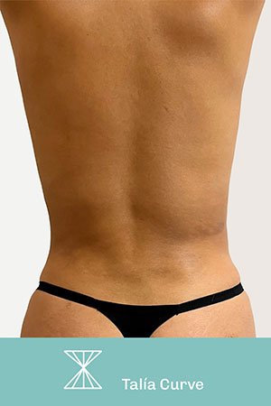 Clínica de cirugía plástica en Quito con el Dr. Leonardo Zambrano