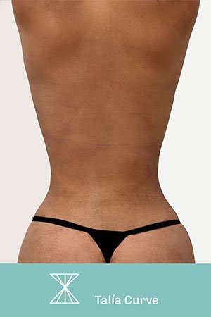 Clínica de cirugía plástica en Quito con el Dr. Leonardo Zambrano