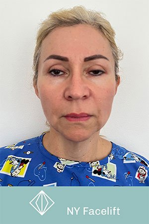 Clínica de cirugía plástica en Quito con el Dr. Leonardo Zambrano