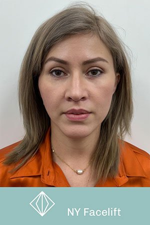 Clínica de cirugía plástica en Quito con el Dr. Leonardo Zambrano