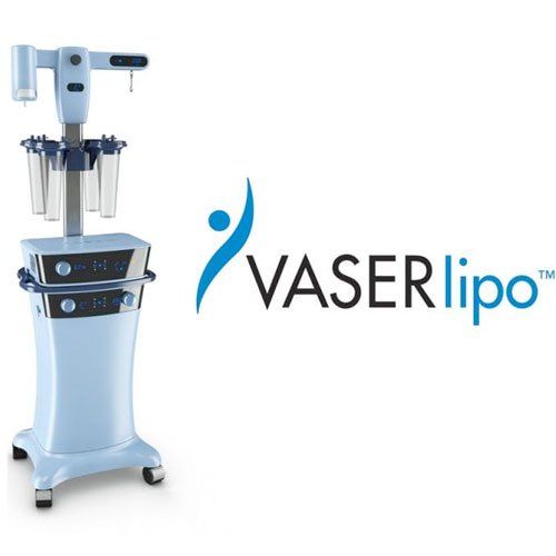 vaserlipo